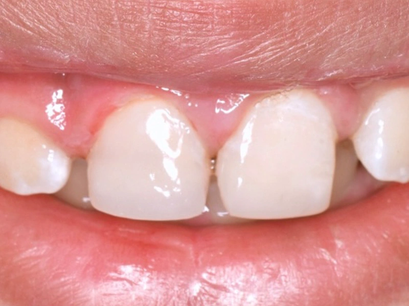 After Image