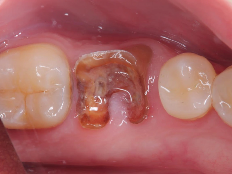 Before Image