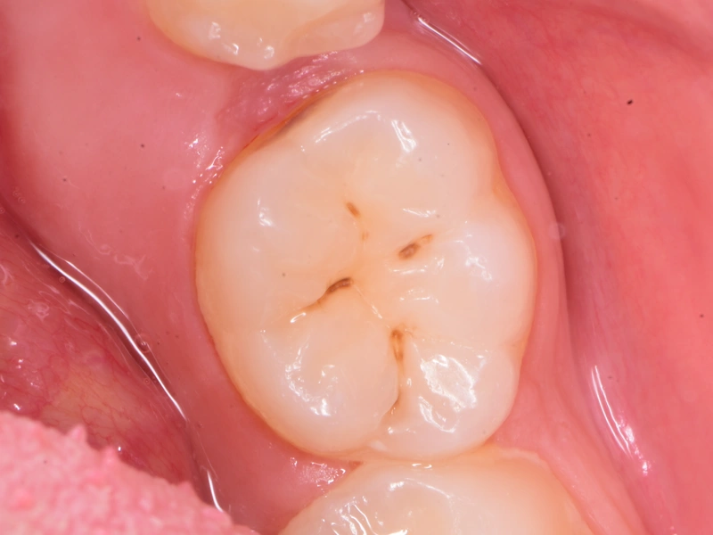 Before Image