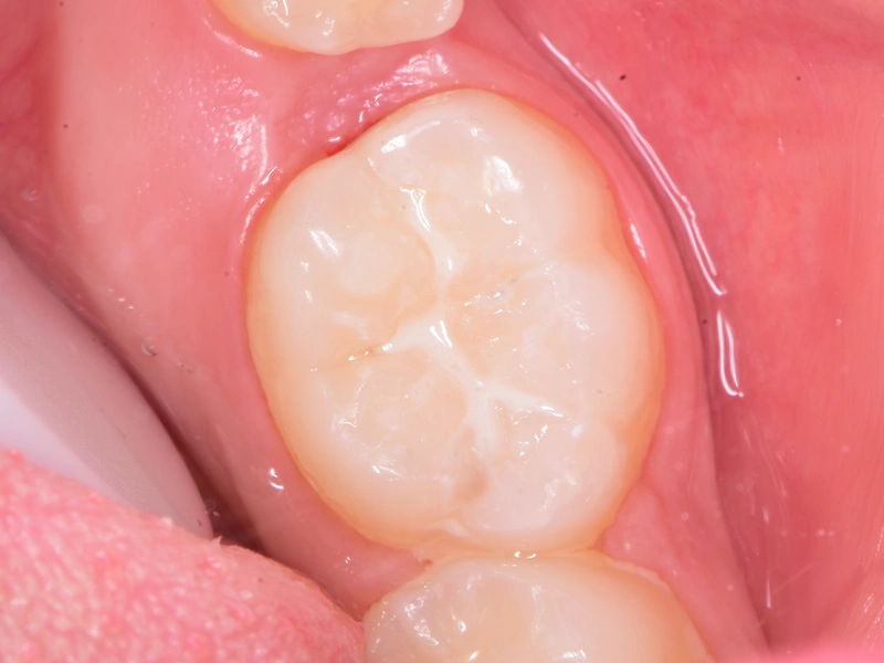 After Image