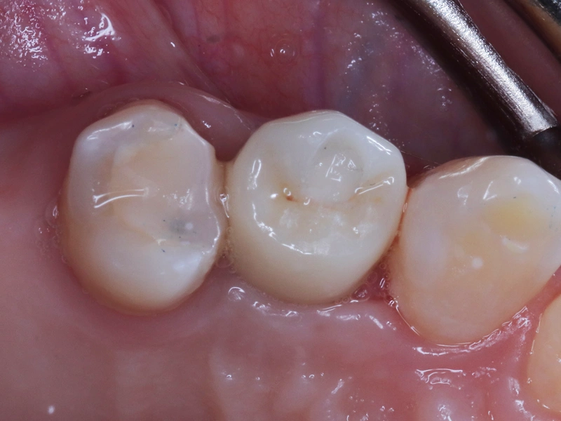 After Image