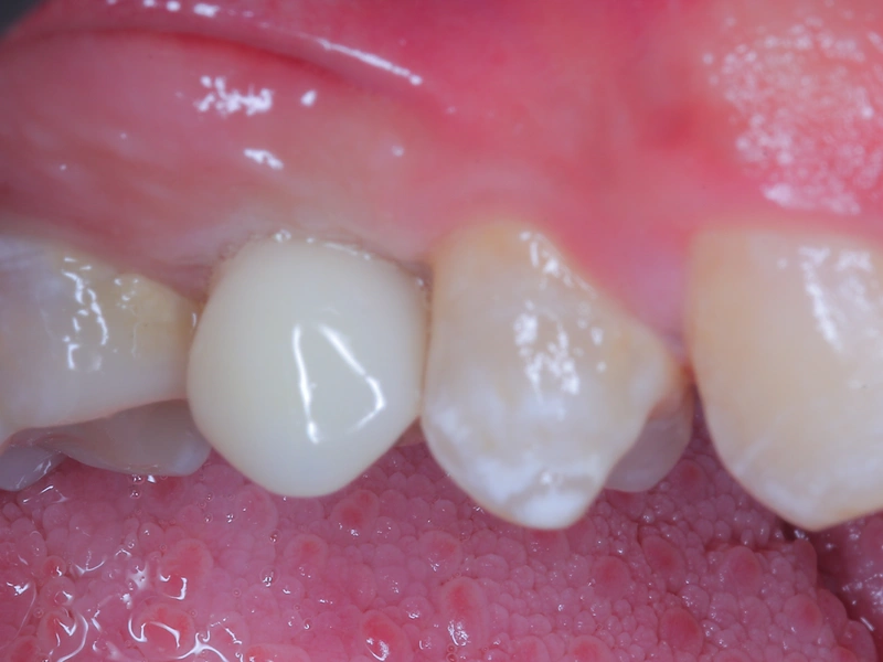 After Image