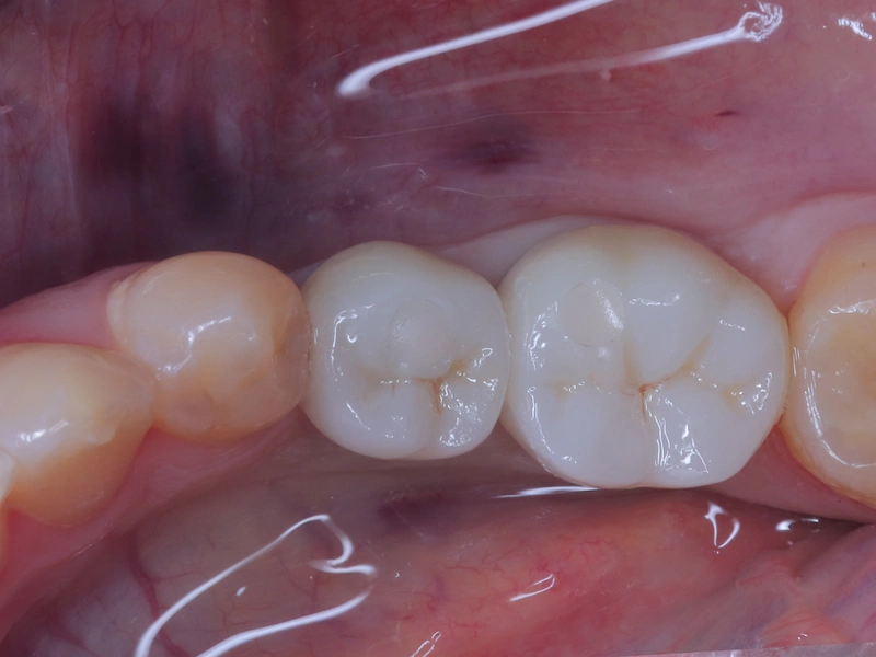 After Image