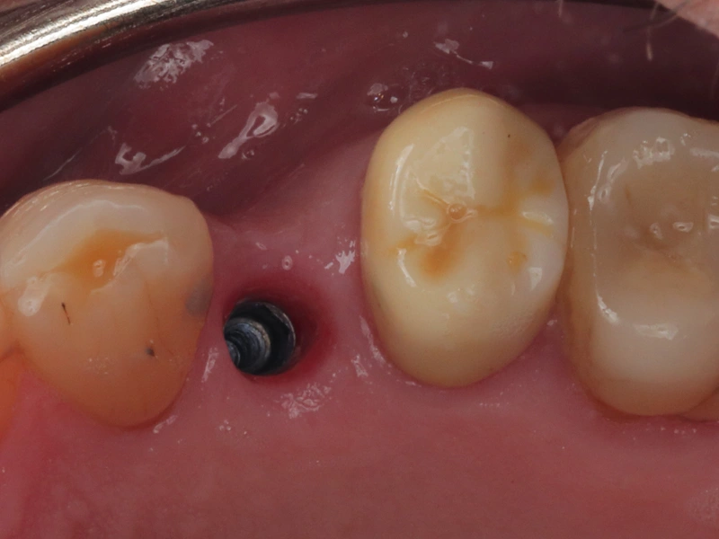 Before Image