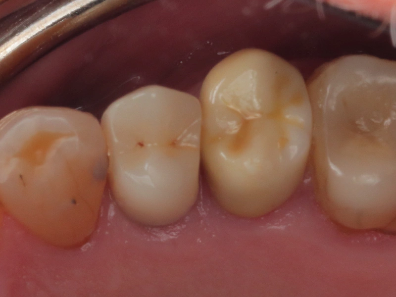 After Image
