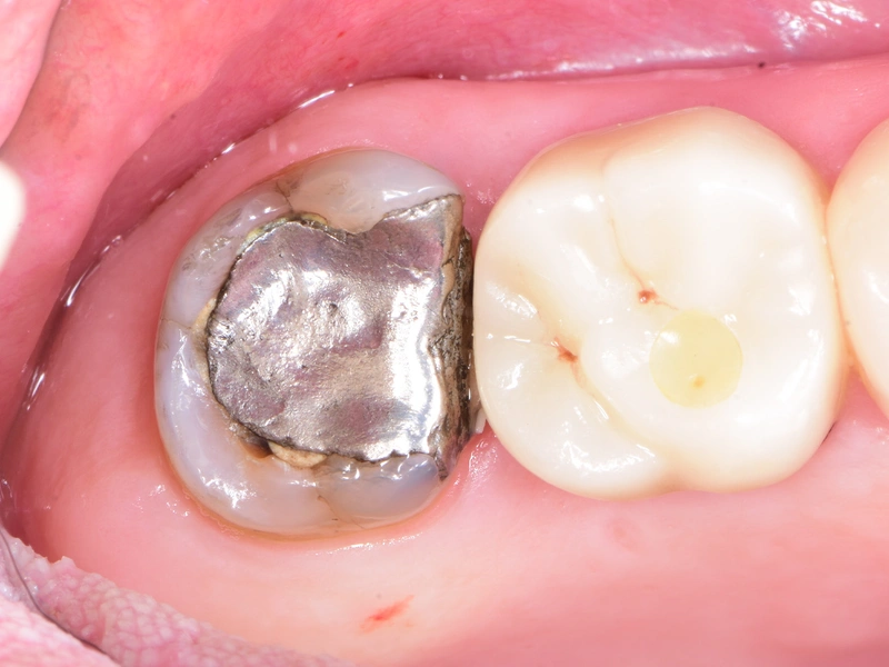 Before Image