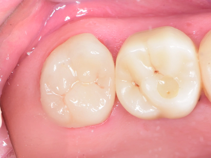 After Image