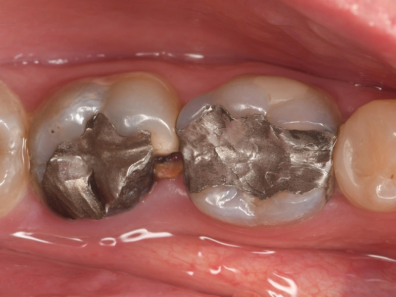 Before Image