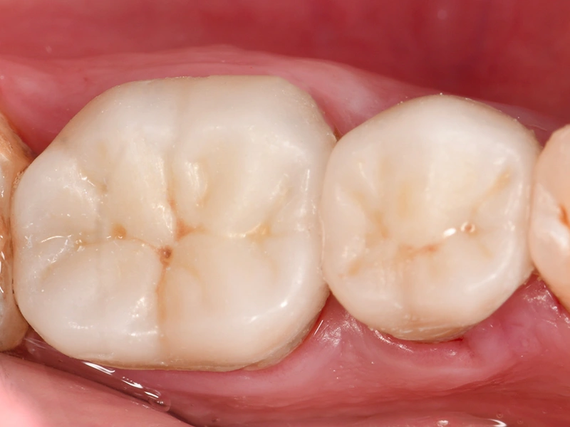 After Image