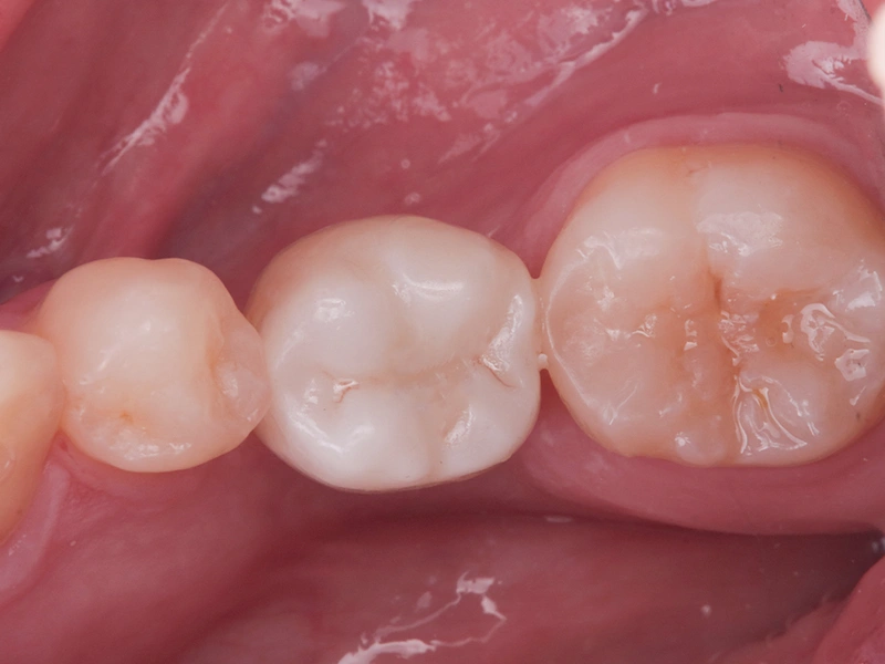 After Image