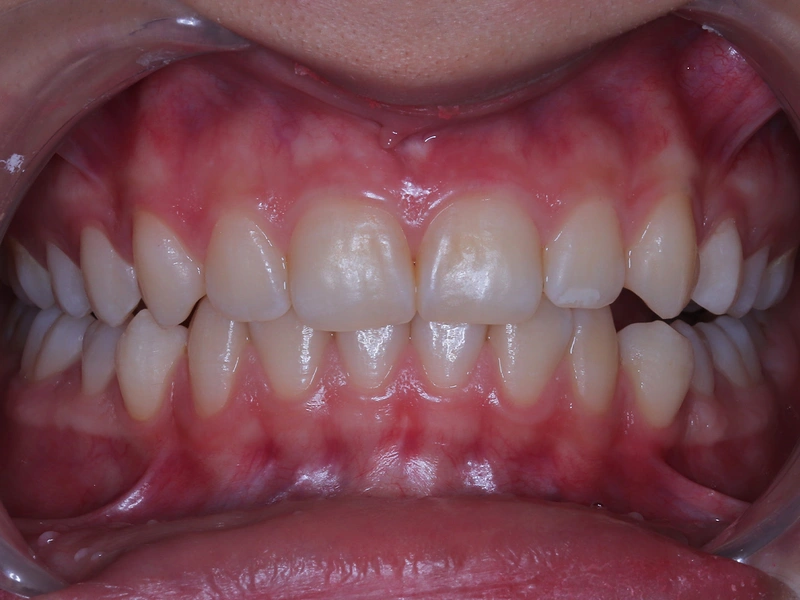 Before Image