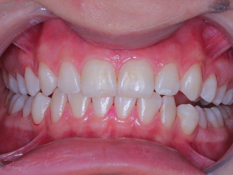 After Image
