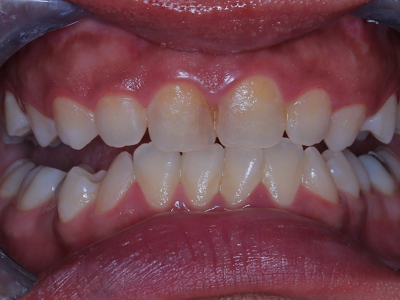 Before Image