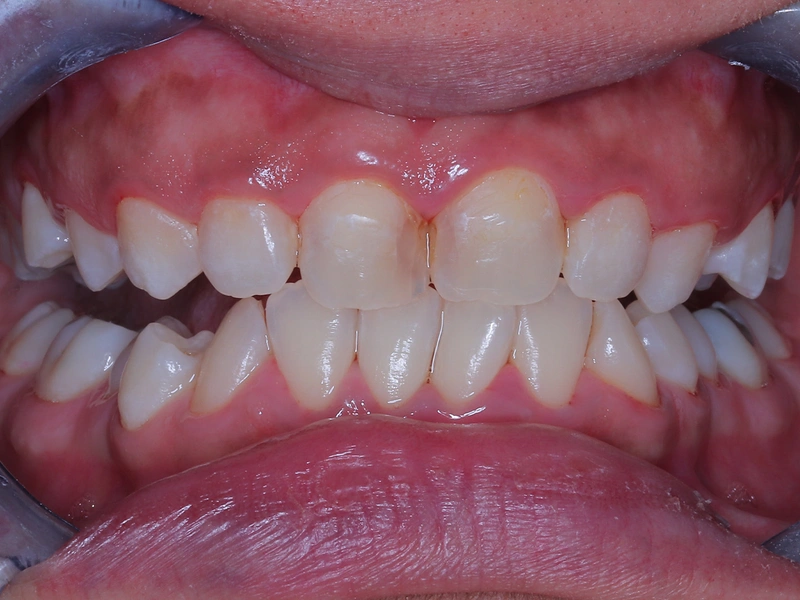 After Image